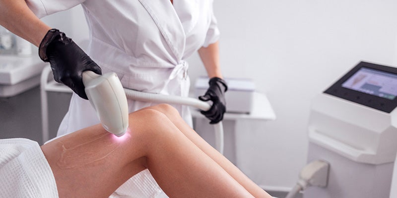 Technician in black gloves uses a laser device with pink light on a patient's leg for hair removal.